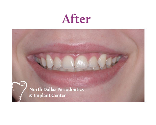 Marjan Adami DDS, Periodontist patient photo