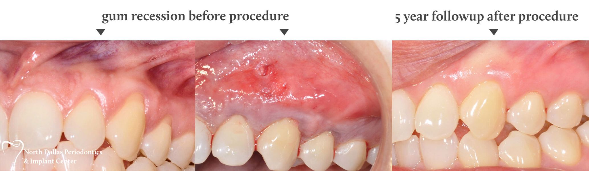 Marjan Adami DDS, Periodontist patient photos