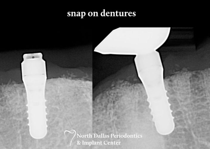 Marjan Adami DDS, Periodontist patient photos