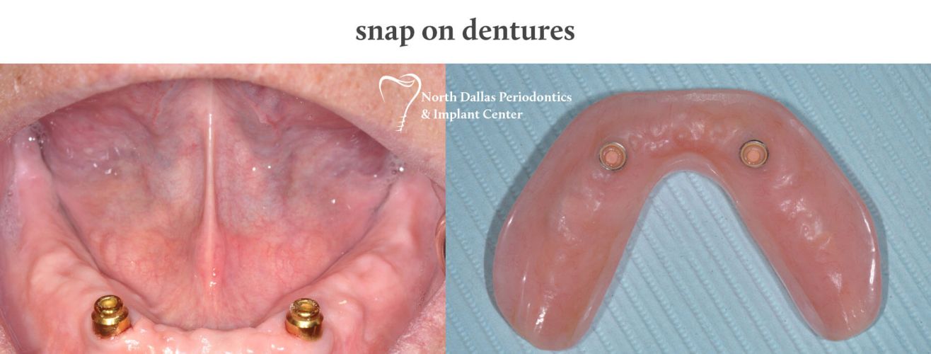 Marjan Adami DDS, Periodontist patient photos